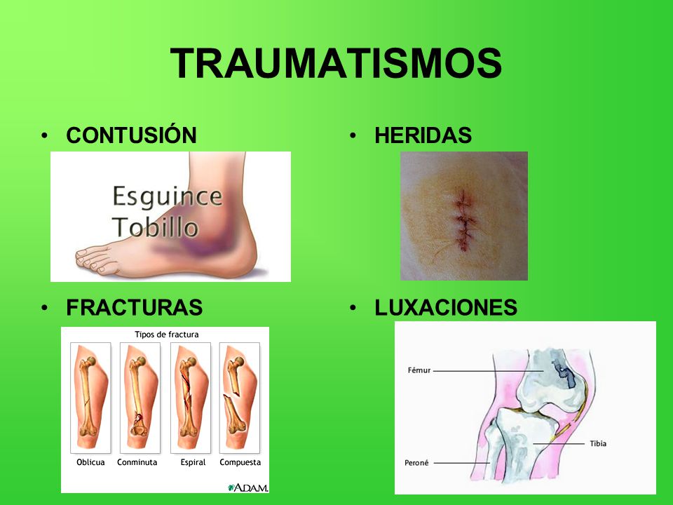 CONTUSIONES HERIDAS FRACTURAS Y LUXACIONES Ppt Video Online Descargar